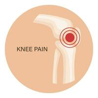 Knie Schmerz, Arthrose, rheumatoide Arthritis. Anatomie von Mensch Knochen. Medizin. Illustration, Vektor