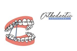 kontinuerlig linje konst av ortodontisk behandling. tandläkare dag och respekt för deras tjänster till mänskligheten vektor