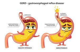 infografik für gesunden magen und gastroösophageale refluxkrankheit vektor