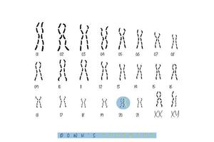 Downs Syndrom Bewusstsein Konzept Kunst. vektor