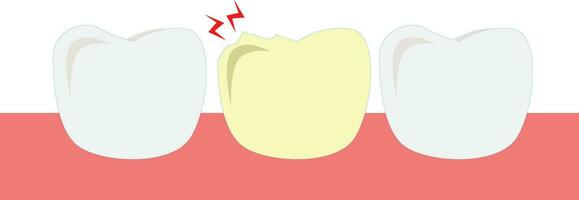 Zähne Charakter Design. Dental Ausrüstung Vektor. schmerzlich Zahn vektor