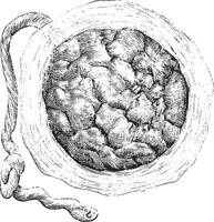Plazenta extern oder Gebärmutter- Seite, Jahrgang Gravur. vektor