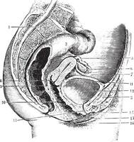 weiblich Becken antero-posterior Abschnitt, Jahrgang Gravur. vektor