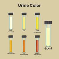 Urin Farbe im Prüfung Röhren Vektor Illustration