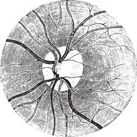 Papille von das Retina mit das klar Bereich Das umgibt Es, vin vektor