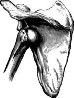 subspinös Luxation von das Humerus, Jahrgang Illustration. vektor