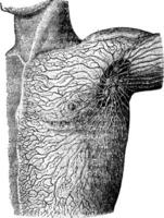 Lymphgefäße von das Schulter, Jahrgang Illustration. vektor