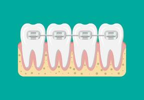 Zähne Zahnspange. Kieferorthopädie und Zahnheilkunde. Mensch Zahn im eben Stil. Dental Konzept. Hygiene und Mundpflege. Vektor Illustration