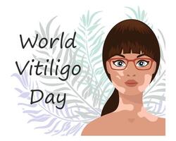 Welt Vitiligo Tag, Bewusstsein Banner. süß Frau mit Vitiligo Krankheit auf tropisch Blätter Hintergrund. Banner, Poster, Vektor