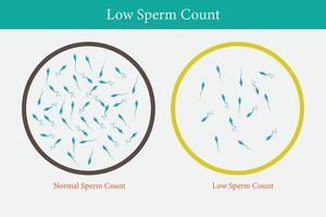 normal und niedrig Sperma Anzahl Illustration. männlich Unfruchtbarkeit Oligospermie. Struktur von das Sperma. Vektor. eps 10 vektor