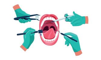 Dental Behandlung. Zahnarzt Hände im medizinisch Gummi Handschuhe mit Instrumente Arbeiten auf geduldig Mund, Oral Pflege Konzept. Vektor Karikatur Illustration