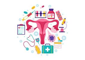 Endometriose Vektor Illustration mit Bedingung das Endometrium wächst draußen das Gebärmutter- Mauer im Frauen zum Behandlung im eben Karikatur Hintergrund