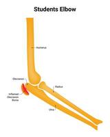 Studenten Ellbogen Wissenschaft Design Vektor Illustration Diagramm