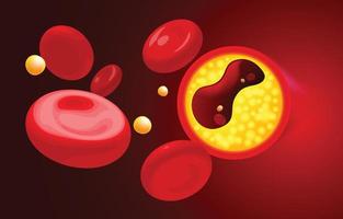 röda blodkroppar och kolesterol täpper till innan hjärtat. vektor
