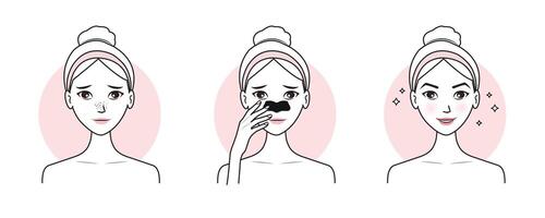 söt kvinna med steg av pormaskar behandling på näsa vektor illustration isolerat på vit bakgrund. innan och efter näsa por remsa ta bort pormaskar på ansikte. hud vård och skönhet begrepp.