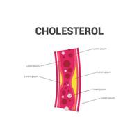 Cholesterin Design Vorlage Illustration . vektor