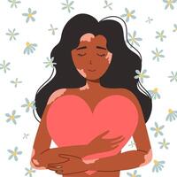 svart kvinna med vitiligo, kropp positivitet, själv kärlek. en kvinna kramar en stor hjärta. illustration vektor