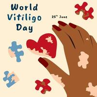 illustration av värld vitiligo dag hälsning med solbränna hud hand och pussel bitar vektor