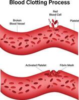 Blut Gerinnung Prozess Illustration vektor