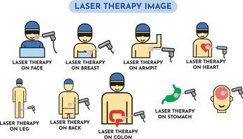 Laser- medizinisch Therapie vektor