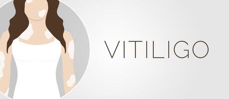 Vitiligo Haut Bedingung Illustration Banner Hintergrund vektor