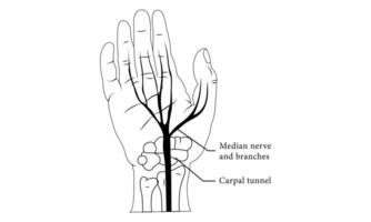 Karpal Tunnel Anatomie Diagramm Illustration Design. vektor