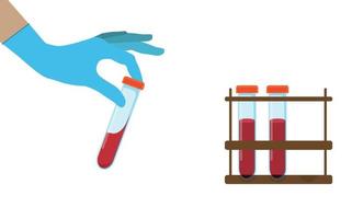 flaskor med blodkomponenter ett provrör med blod, ett medicinskt provrör i händerna på en medicinsk arbetare. vektor illustration