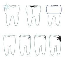 Tanduppsättning. Tänder vitt tecken. Dental medicinsk isolerad colection. vektor