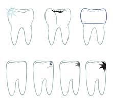 Zahn eingestellt. Zähne weißes Schild. Zahnmedizinische medizinische getrennte Ansammlung. vektor