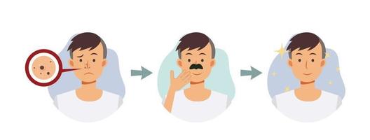 ansiktshud behandling koncept, akne problem. acne på nose.step av en man ta bort akne från hans näsa. platt vektor seriefigur illustration.