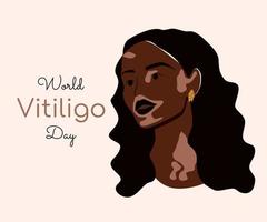 ung afroamerikansk kvinna lever med vitiligo. olika skönhet, självkärlek och hudsjukdomskoncept. världsvitiligodagen. platt vektorillustration isolerad på beige bakgrund vektor