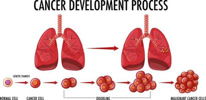 infografik zum krebsentwicklungsprozess vektor