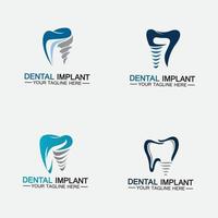 Zahnimplantat-Logo-Vektor entwirft Konzeptvorlage vektor