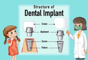 infographic av människa i strukturen av tandimplantatet vektor