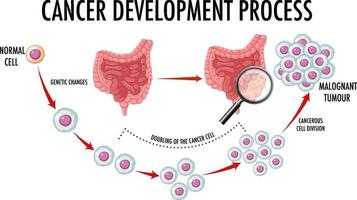 Diagramm, das den Krebsentwicklungsprozess zeigt vektor
