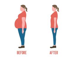 Körperform Frauen vor und nach Gewichtsverlust vektor