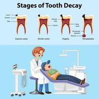 poster stadien der zahnfäule mit dem zahnarztmann, der die zähne des patienten untersucht vektor