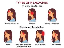 Arten von Kopfschmerzen. Vektor-Infografik. vektor