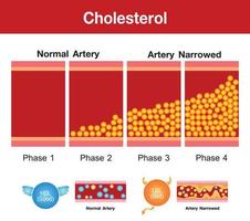 kolesterol i artären, hälsorisk, vektordesign vektor