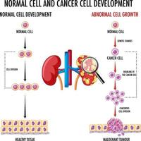 Diagramm, das normale und Krebszellen zeigt vektor