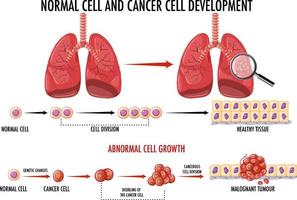 Diagramm, das normale und Krebszellen zeigt vektor