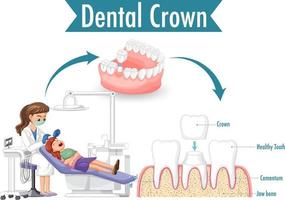 infographic av människa i tandkrona på vit bakgrund vektor