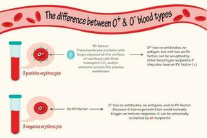 skillnaden mellan o positiva och negativa blodtyper vektor