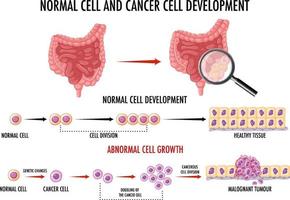 diagram som visar normala celler och cancerceller vektor