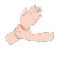 Bildgrafiken Vektorskizze Schmerzen im Handgelenk werden oft durch Verstauchungen oder Frakturen durch plötzliche Verletzungen verursacht Konzept Gesundheitsversorgung vektor
