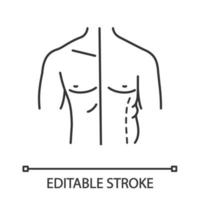 männliches coolsculpting lineares Symbol. Flankenkorrektur. männliche Fettabsaugung und Körperformung vorher und nachher. plastische Chirurgie. Kontursymbol. Vektor isoliert Umrisszeichnung. editierbarer Strich