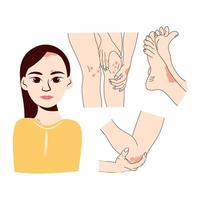 Körperteile einer jungen Frau mit Psoriasis. Vektor-Illustration vektor