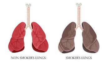 Illustration von normalen gesunden Lungen und Lungenrauchern. Konzept der Raucherentwöhnung. Vektor-Illustration. vektor