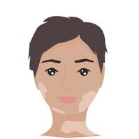 Porträt einer Frau mit Vitiligo. selbstakzeptanz, selbstliebekonzept. Poster, Banner, Karte Welt-Vitiligo-Tag vektor