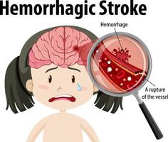 flicka med hemorragisk stroke vektor